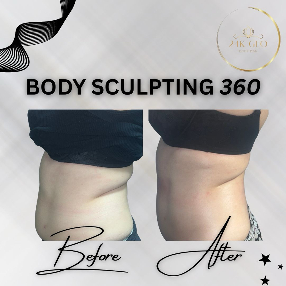 Body Sculpting 360