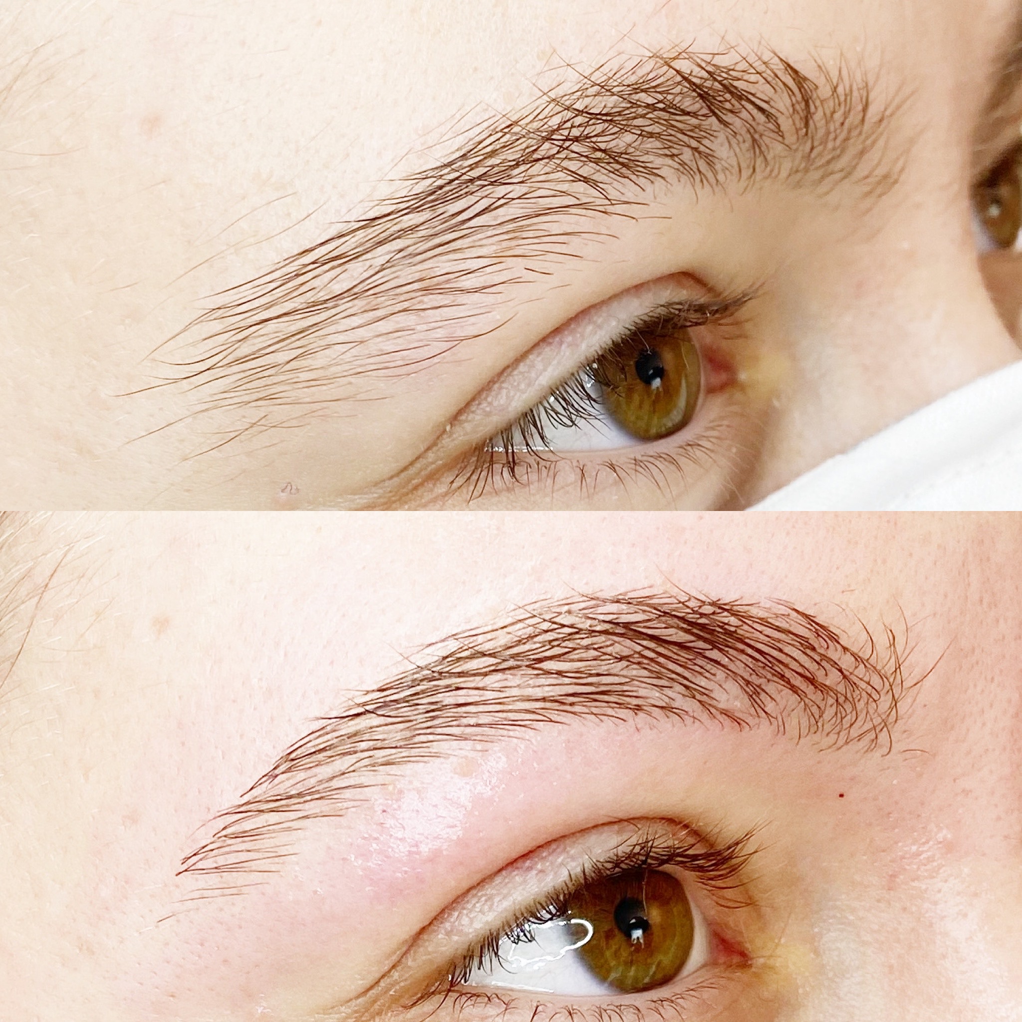 Brow Rehab (3 appointments)