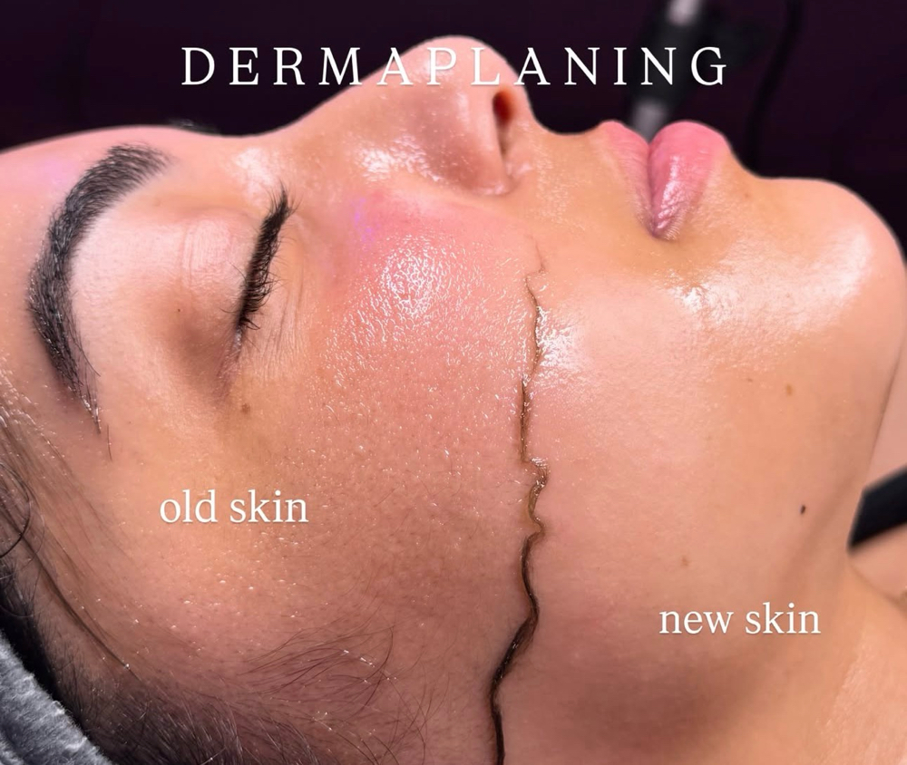 Dermaplane Add On at Thehoustonfacebar in Houston, TX