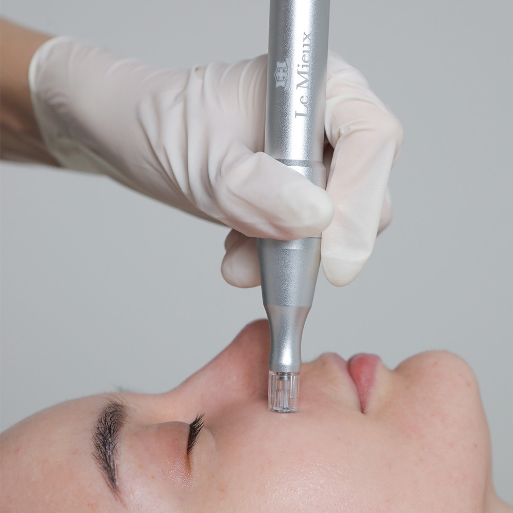 Derma Pen Nanochanneling Add-On at The Ritual Aesthetics in Rocklin, CA