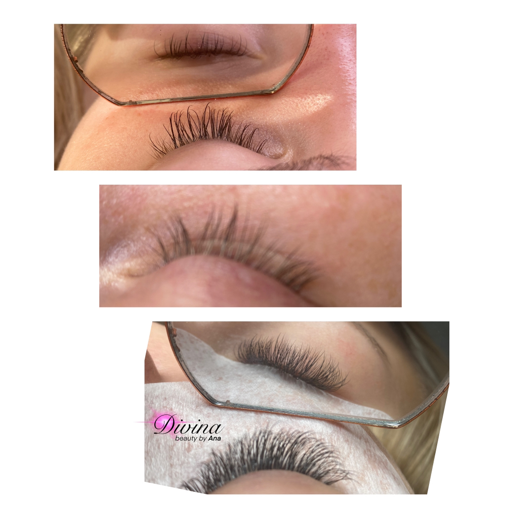Hybrid Set + Lash Removal