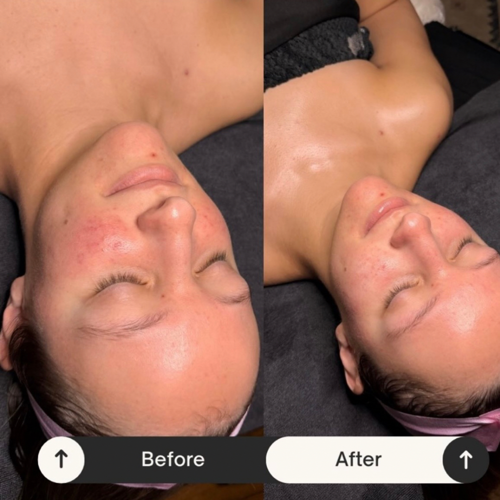 Clarify & Calm Facial at KW Beauty in Murphy, NC