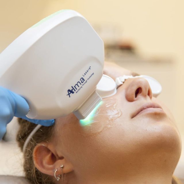 IPL Facials and Services