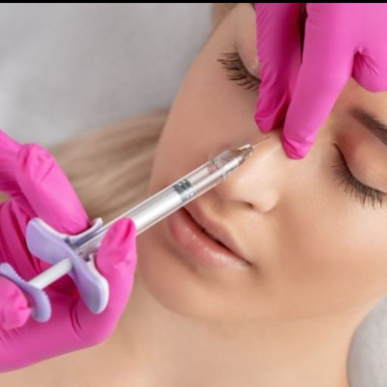 Non surgical Rhinoplasty at TLN AESTHETICS MEDSPA in Lanham, MD