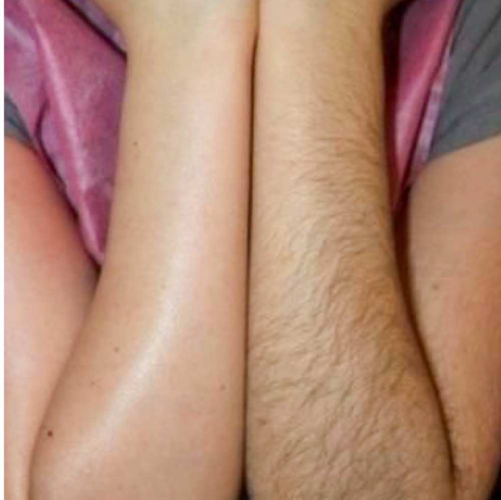 Full Arms Wax- Extended Service at Gegee's Spa on Devine in Columbia, SC