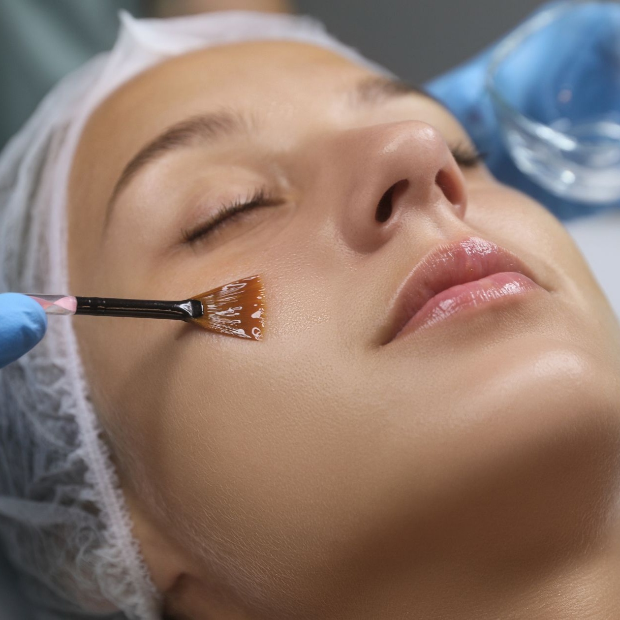 Skin Renewal Peel at The Bohemian Spa in Kissimmee, FL