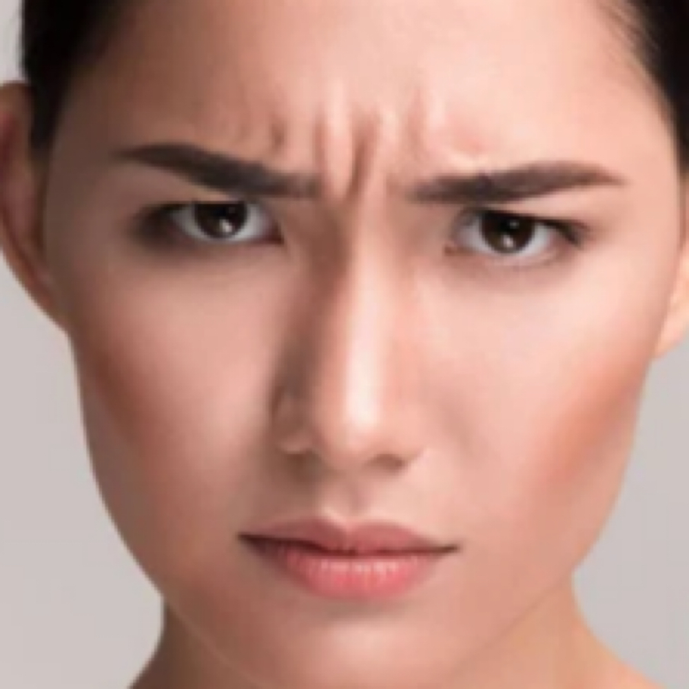 Glabella Lines Botox at Finesse Sculpt Body Studio in Parkville, MD