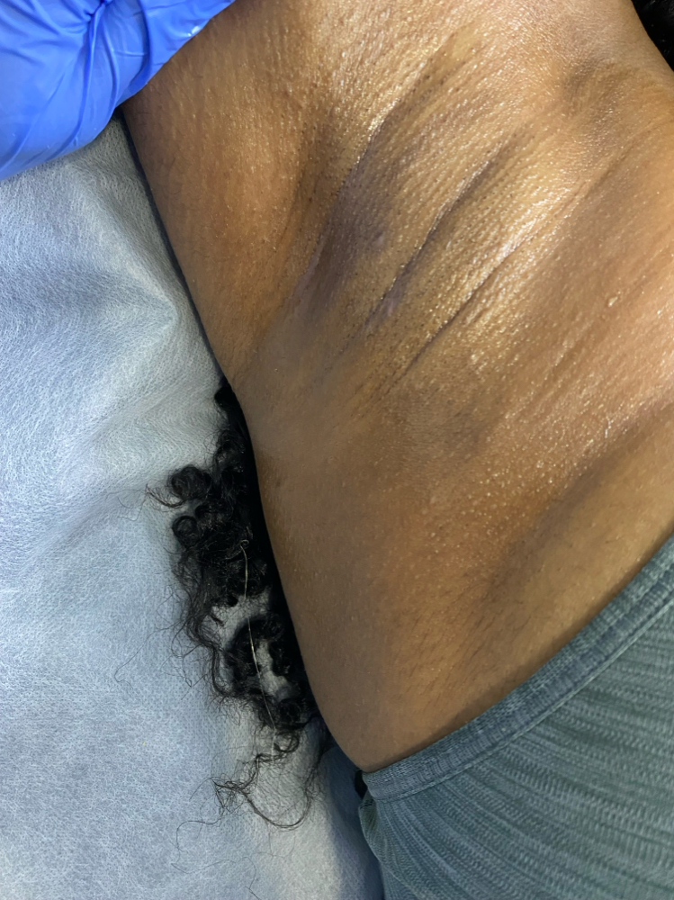 Waxing - Underarms
