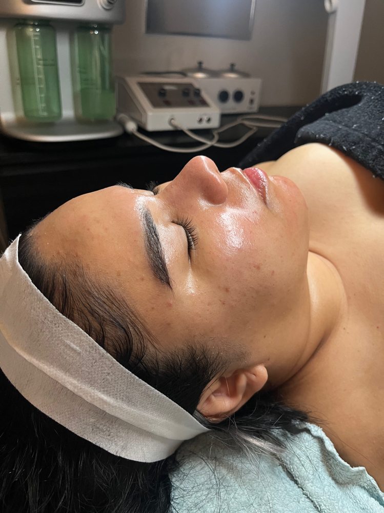 Peel ADD ON