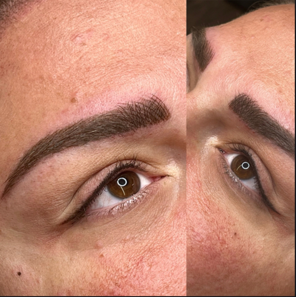 Lash enhancement