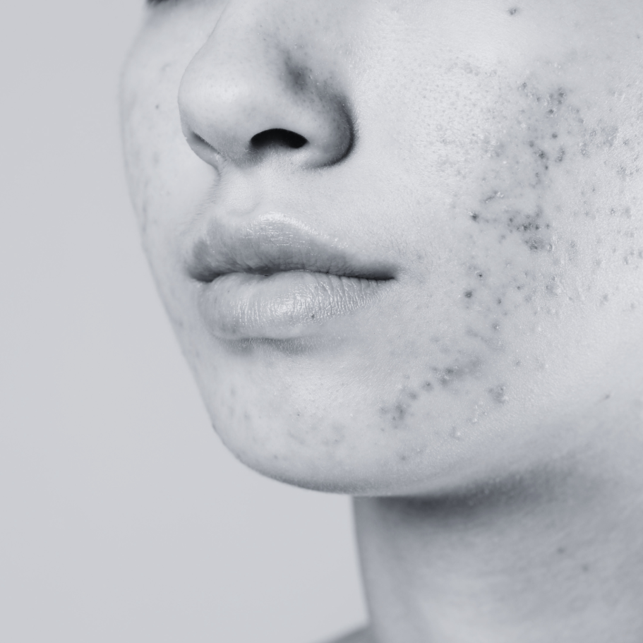 Devoted to Clarity at Devotion Skin Spa in Addison, TX