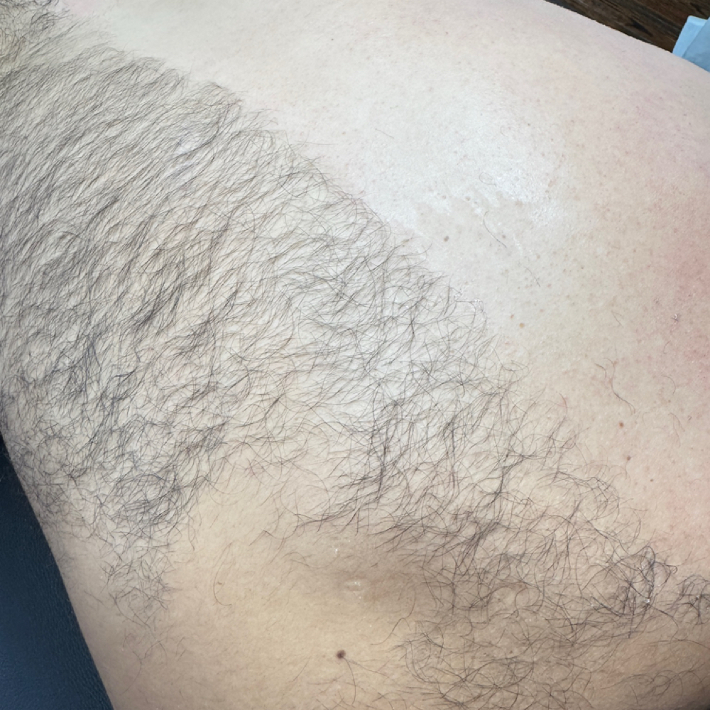Back Waxing at Brows & More in Jacksonville, FL