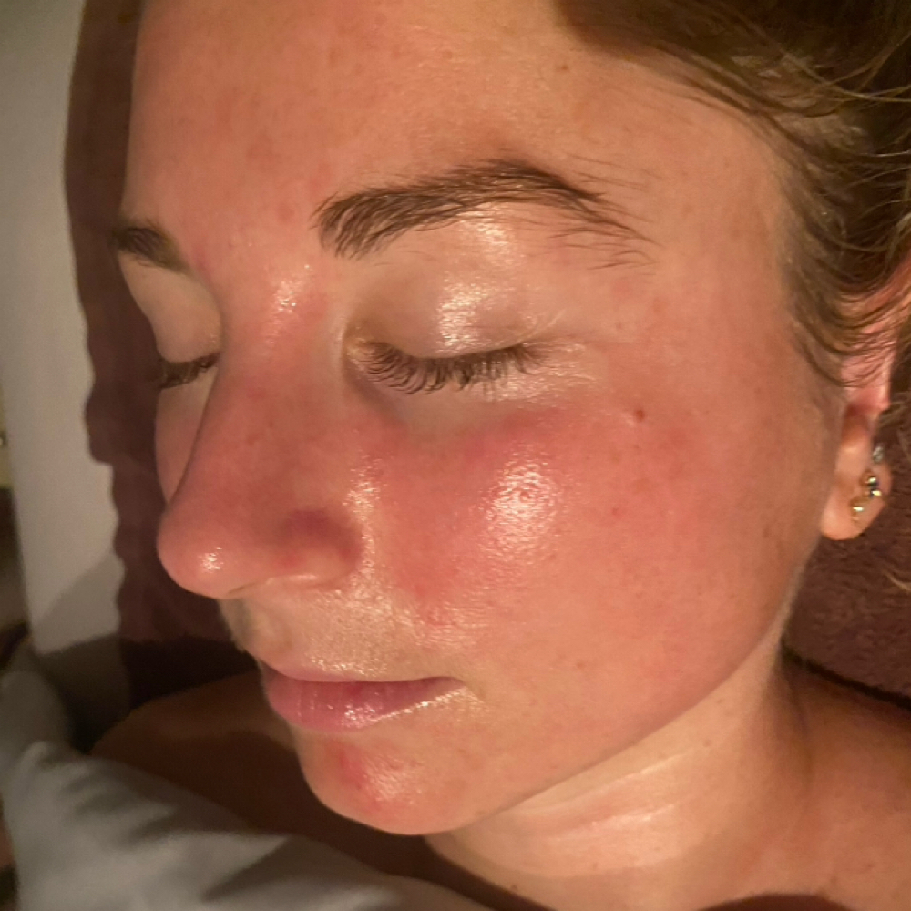 🍃 Green Tea Calming Facial at Theirieeallureaesthetics in Warner Robins, GA
