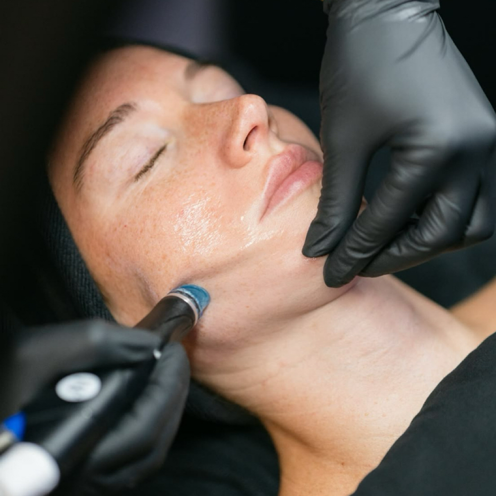 Express Hydrafacial at Anfissa Beauty in Mount Angel, OR