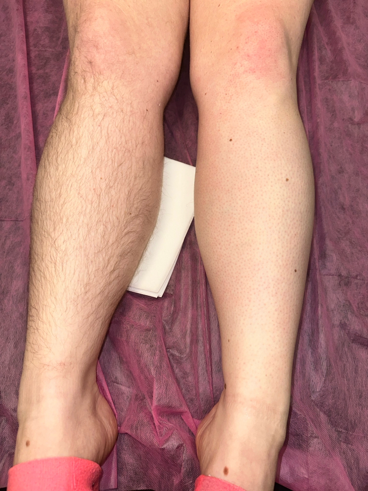 Full Leg Wax