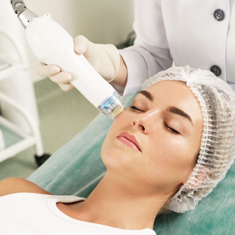 Fractional Radiofrequency Skin at Leidy Cornelio Spa in Aurora, CO