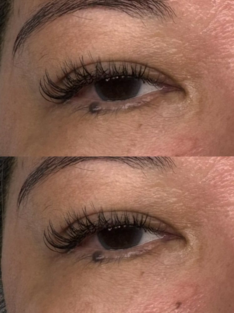 Classic Set โฅ๏ธ