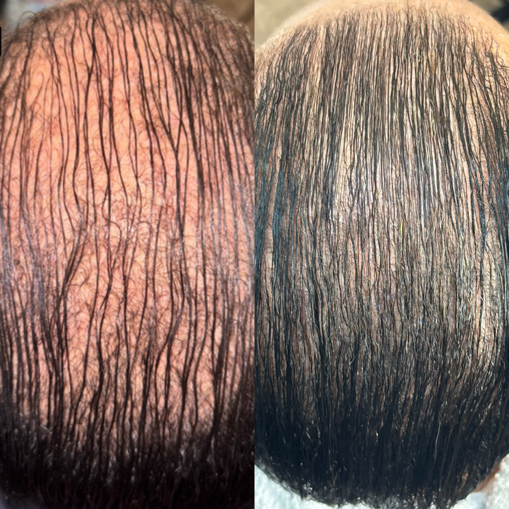 Omni RESTORE Experience