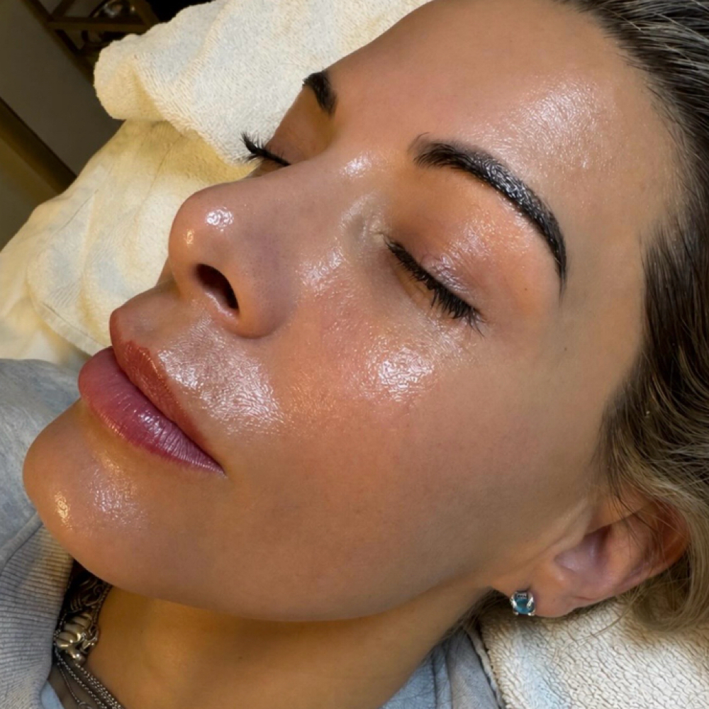 Chemical Peel add-on at Skin Love Worthington in Worthington, OH
