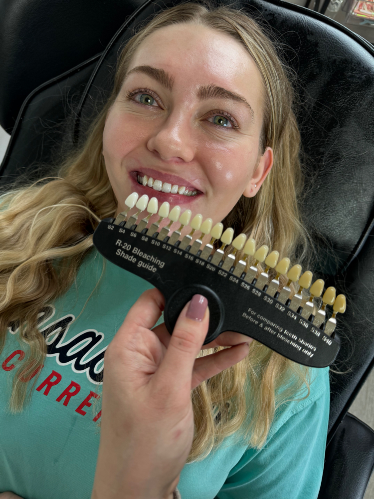 Teeth Whitening 20min
