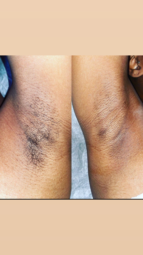 Underarm Wax