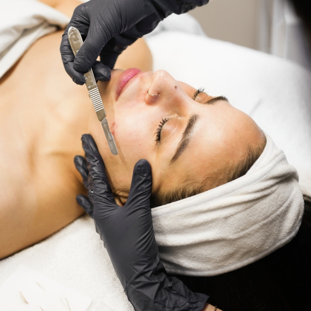 Dermaplaning Facial at CQ Beauty & Esthetics in Modesto, CA