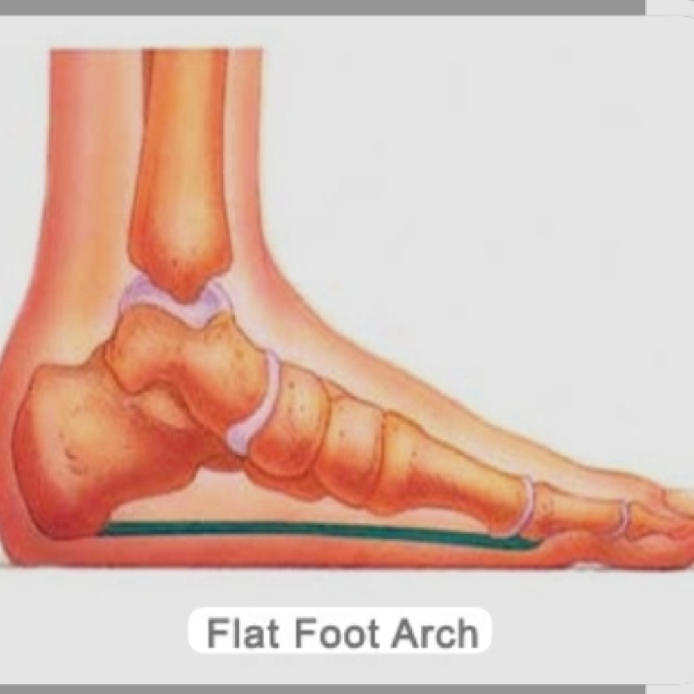 Plantar Fasciitis/ Reflexology Pedi at Chicago's Favorite Nail Spa in Lansing, IL
