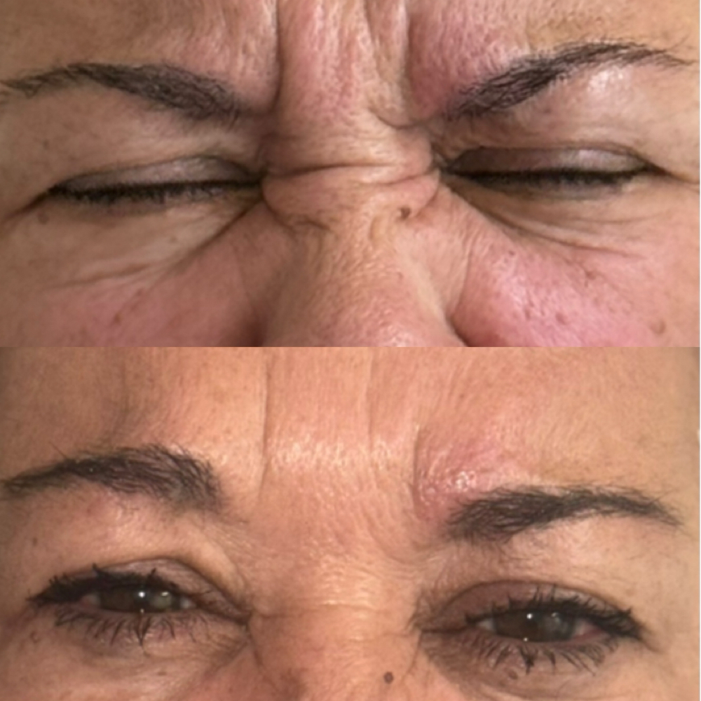 Bunny Lines at Modern Aesthetics LLC in Corpus Christi, TX