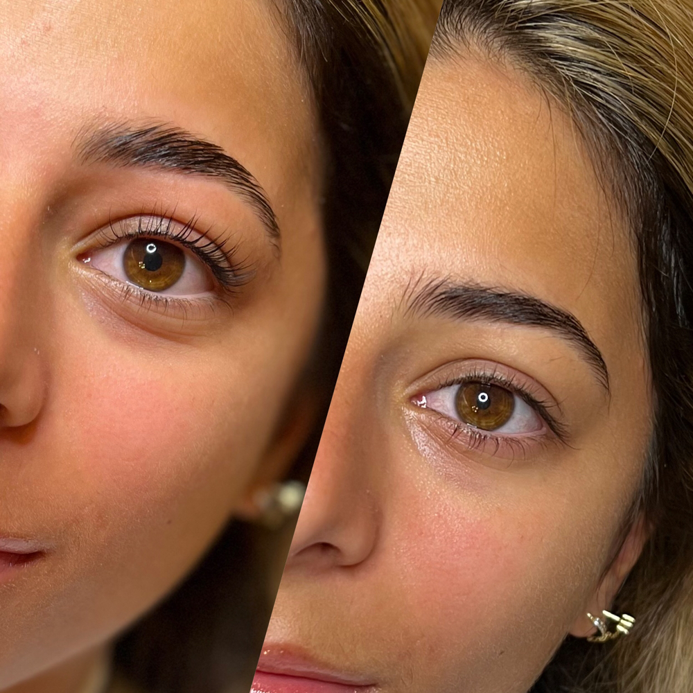 Brow Lamination