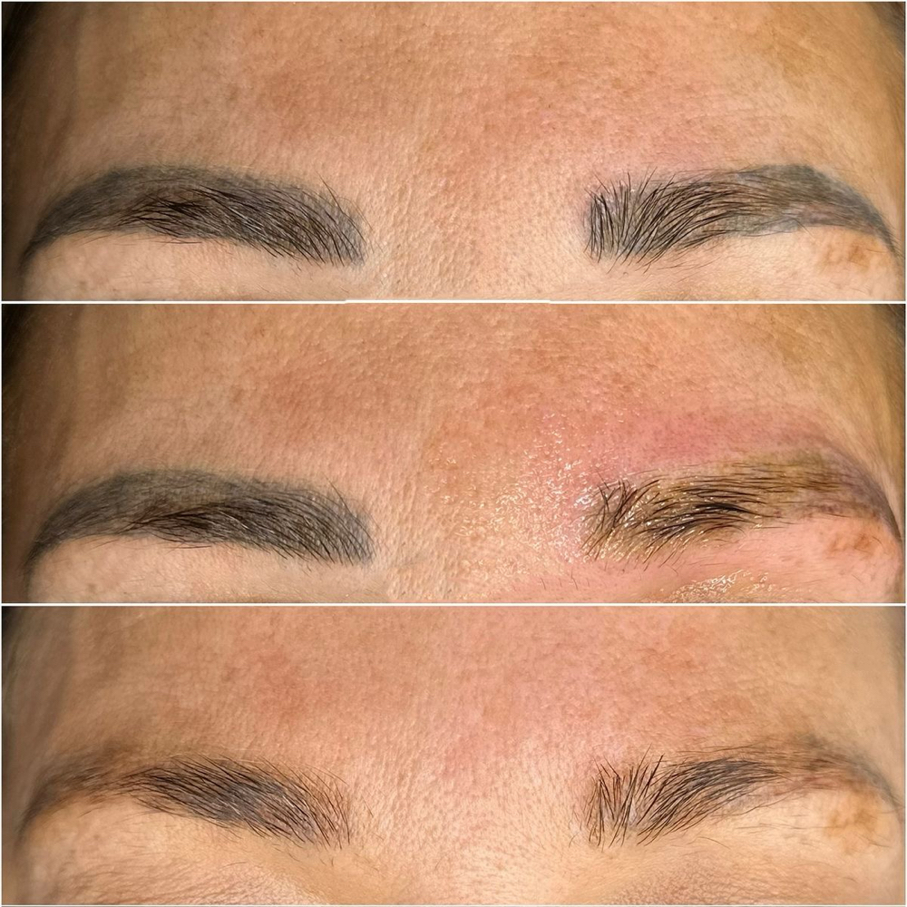 Eyebrows Removal at Sunset Studio in Las Vegas, NV