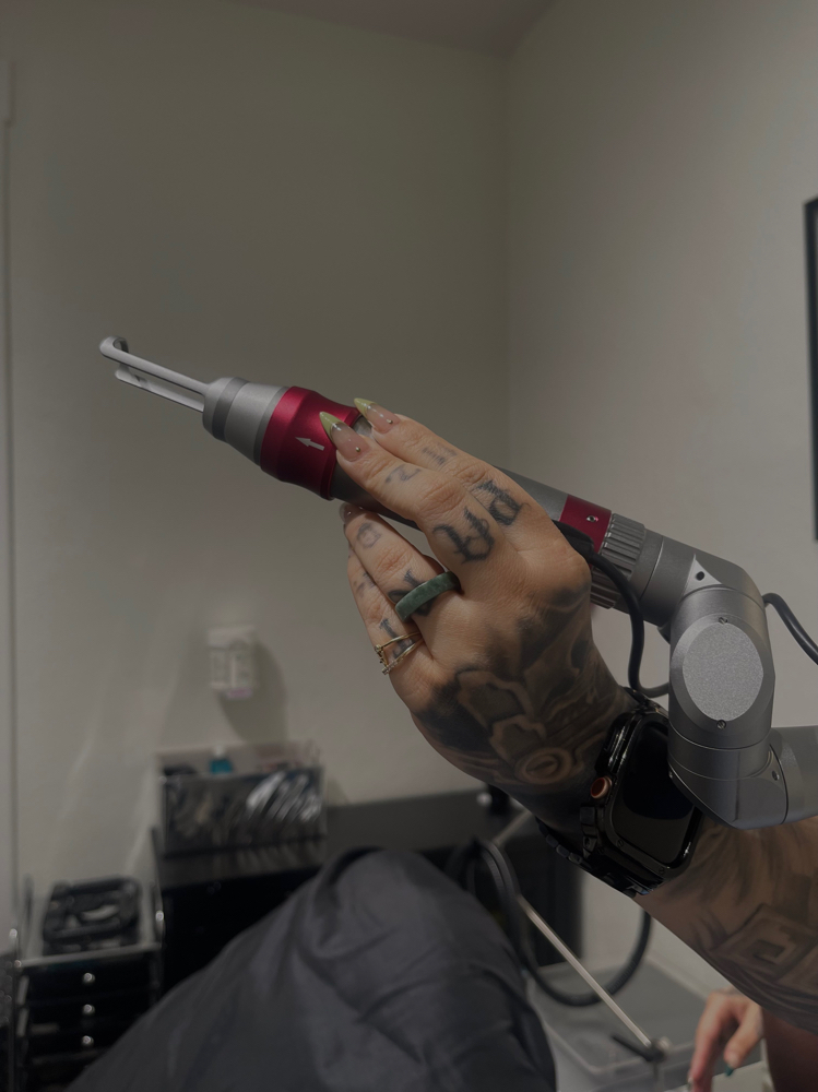 Tattoo Removal at Mayumi Aesthetics in Covina, CA