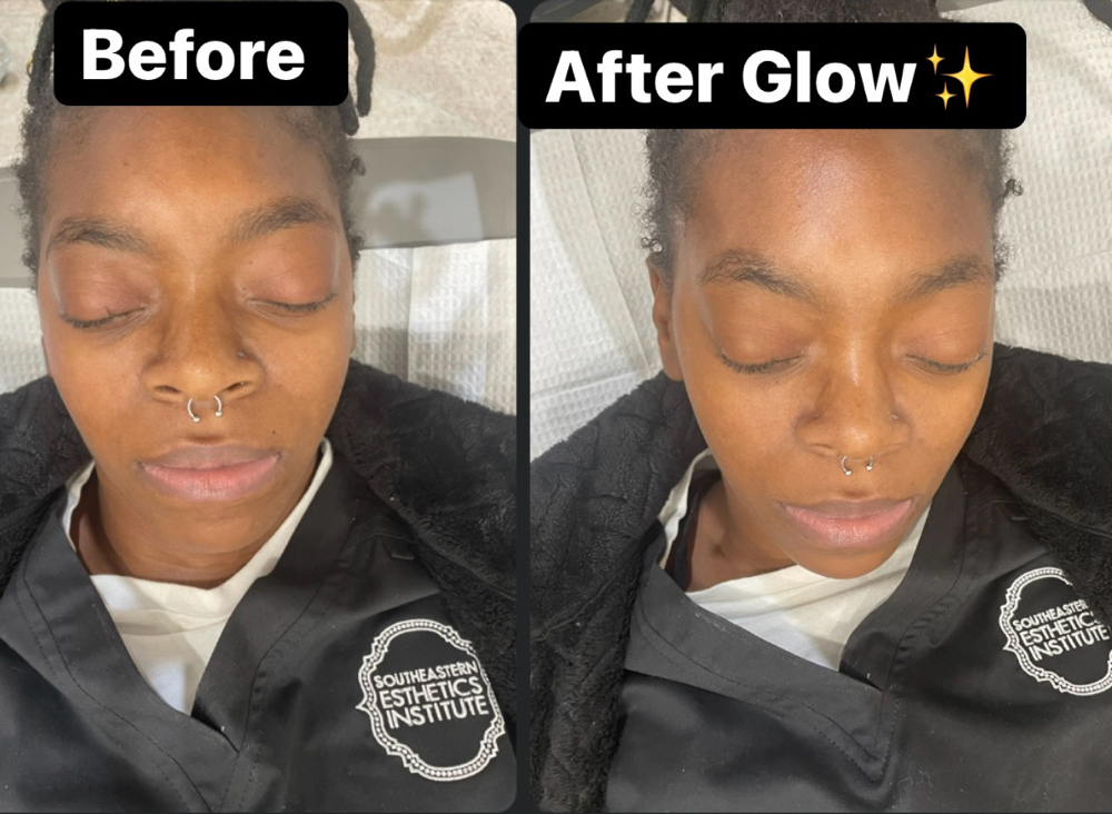 Hydrating Facial