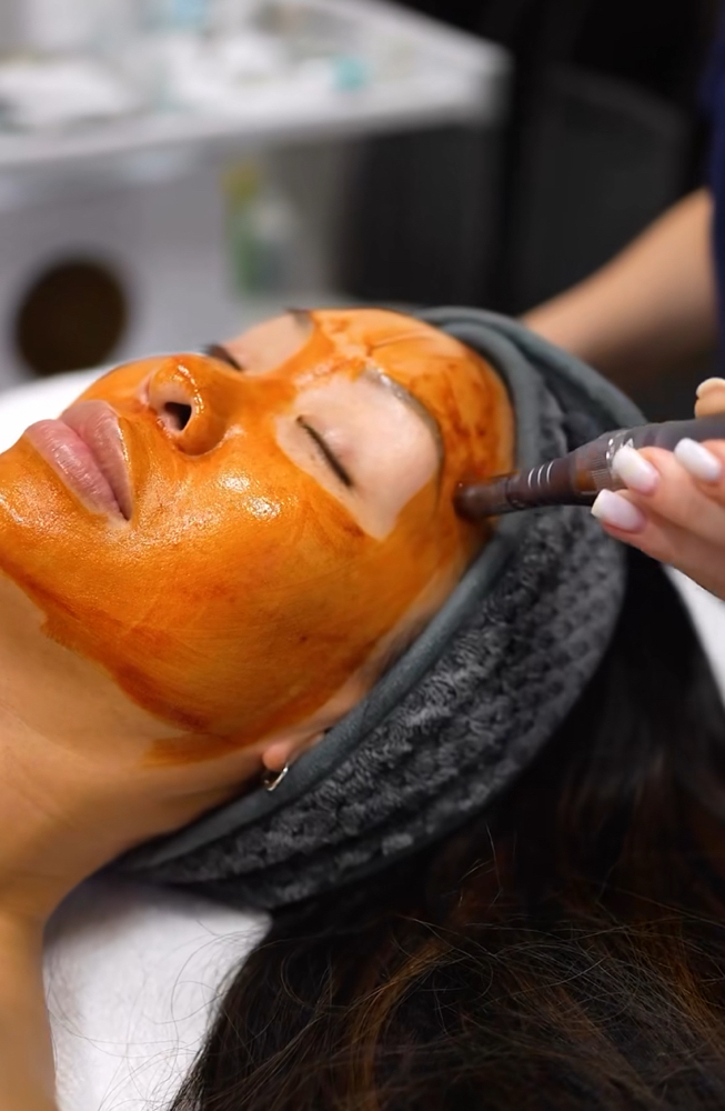 Revitapen infusion Facial