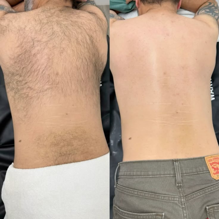 Full back wax at House of Belynn in rockwall, TX