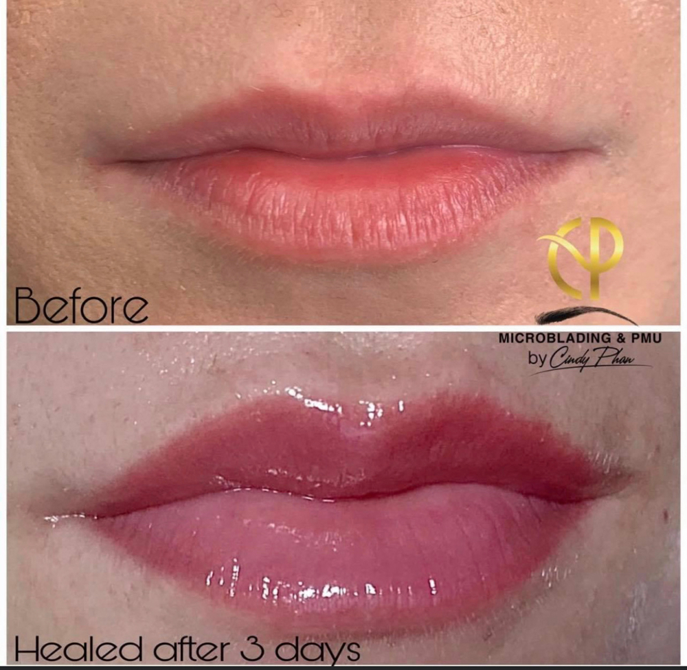 Lips Yearly Touch Up