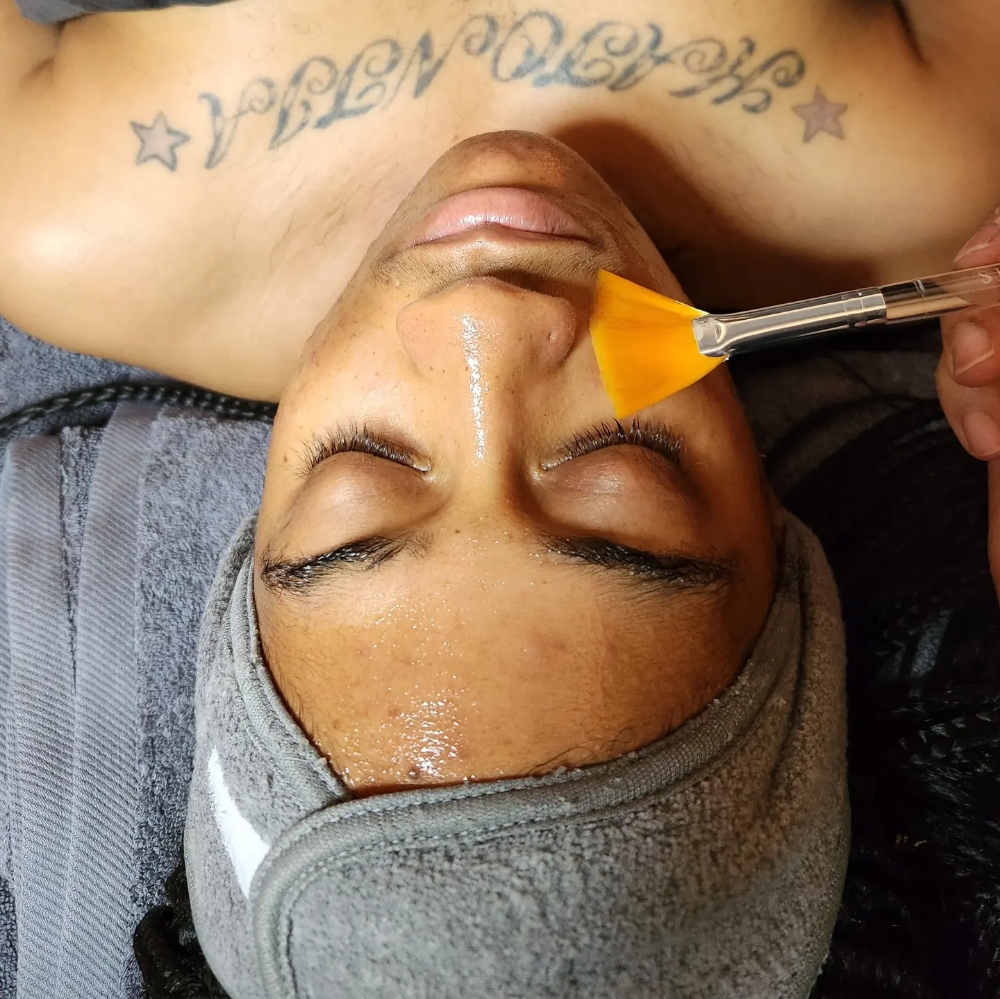 Custom Peel Facial/6 Sessions