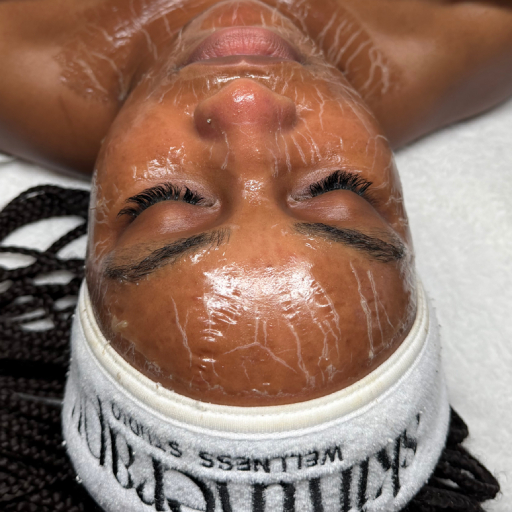 SKIN 03 at Skin Therapy in Golden valley, MN