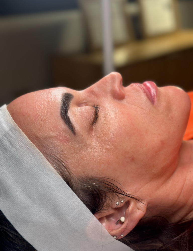 dermaplaning with LED light therapy