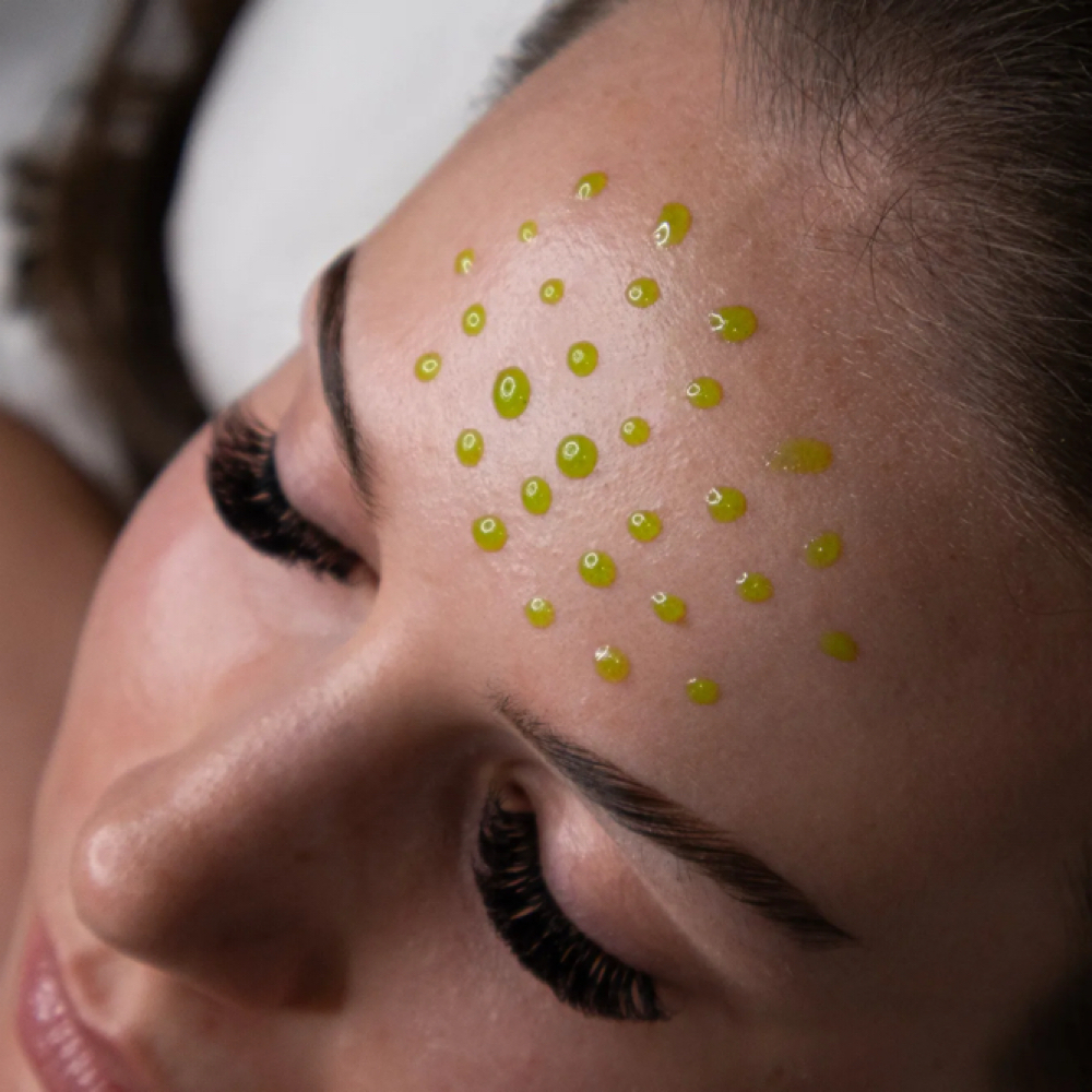 Add BioRePeel To Microneedling at Skin & Syringe Aesthetics in Rockwall, TX
