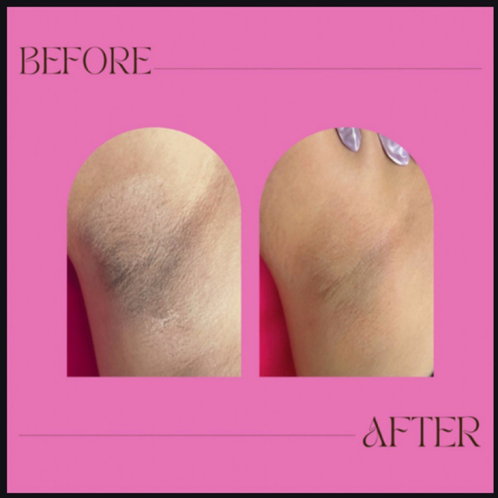 Underarm Wax at True Beauty Esthetics in Lufkin, TX