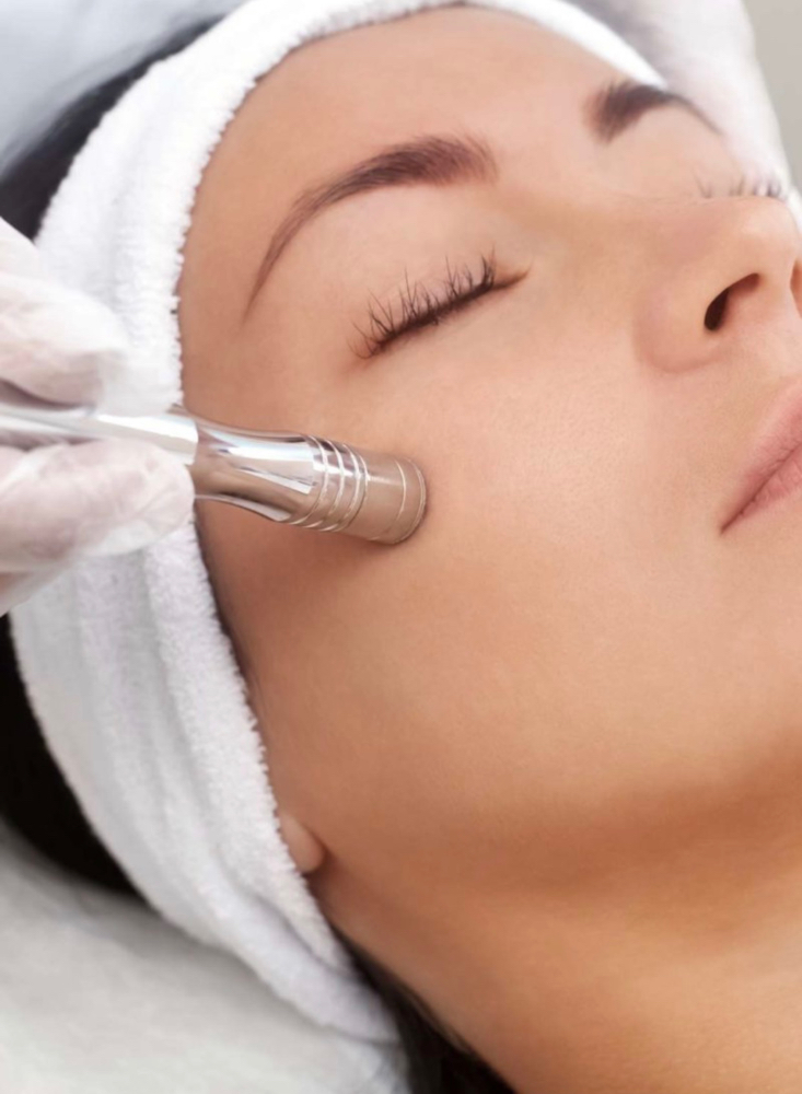 Microdermabrasion Facial