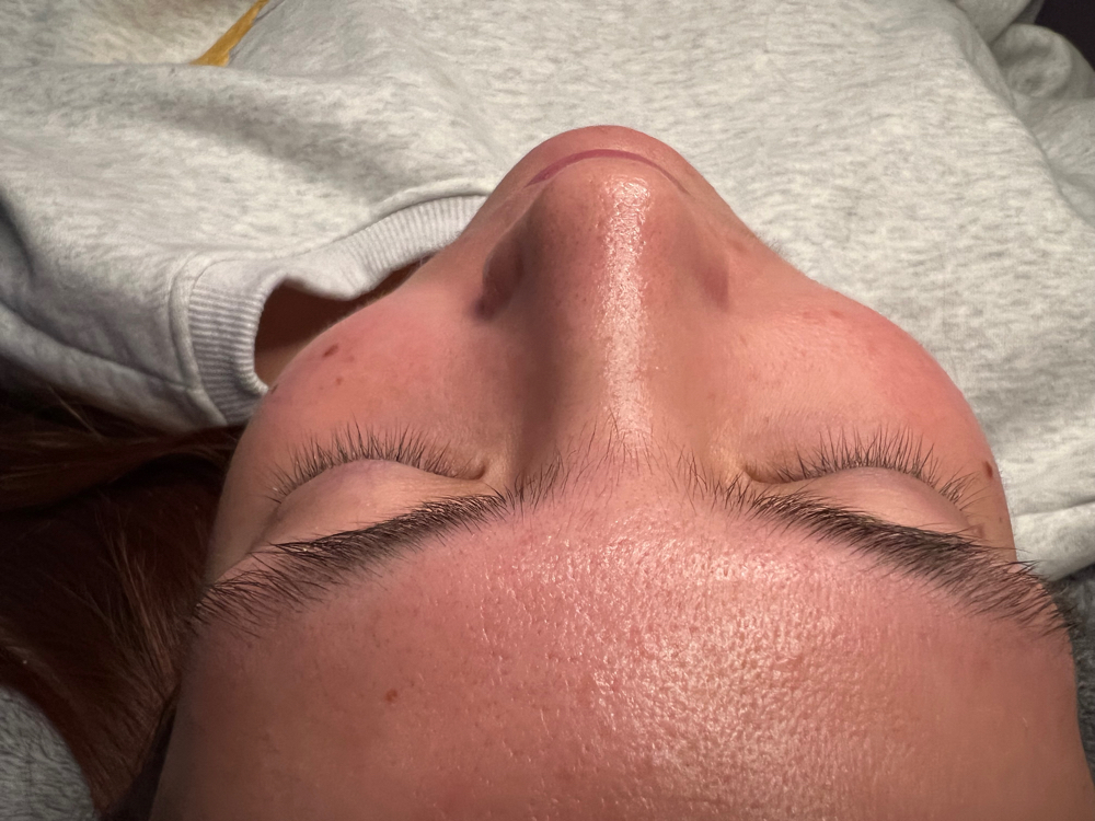 Lash Removal