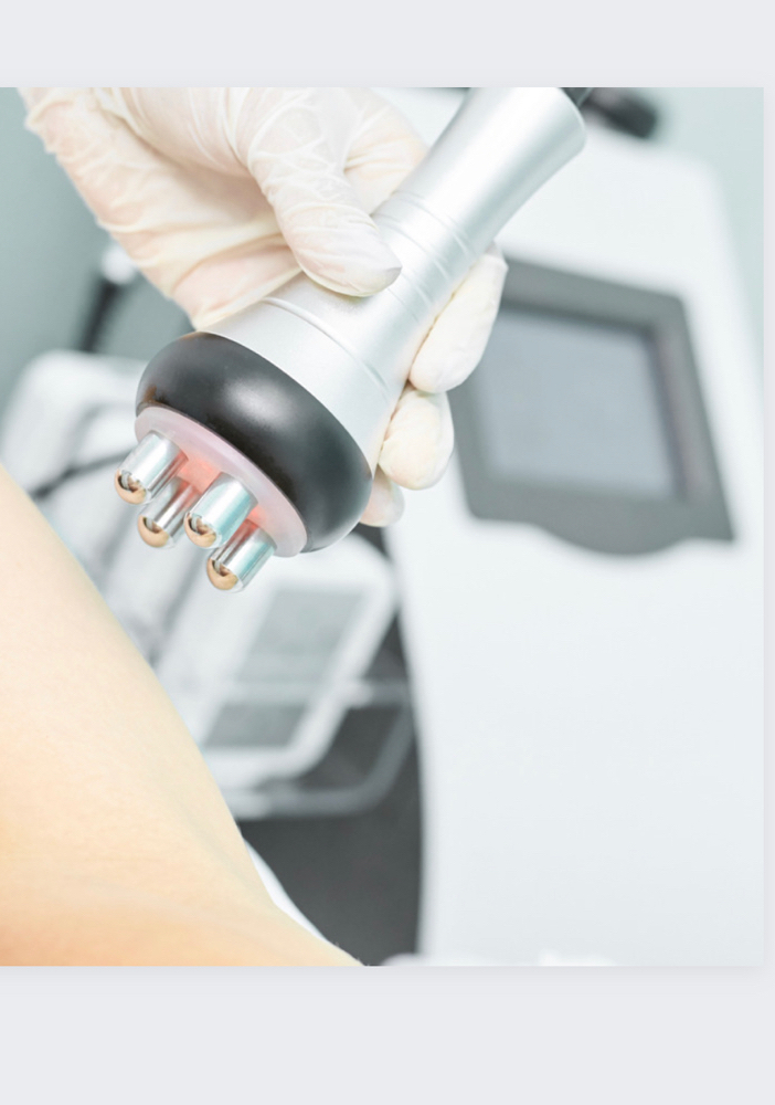 Post-op RF at Yesenia Venegas in Chicago, IL