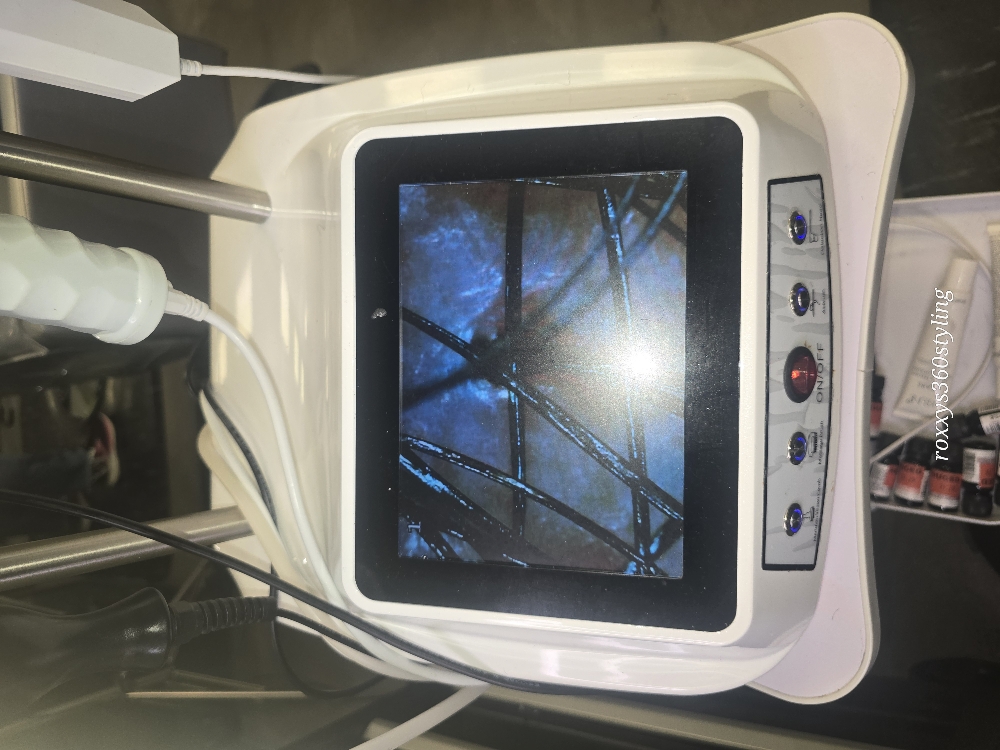 Scalp Detox AND SCOPE ADD ON