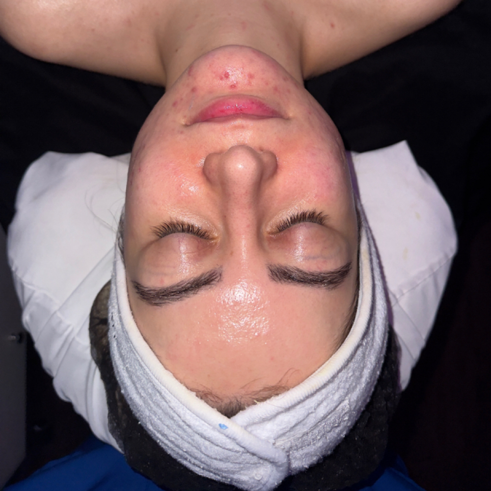 Jan Marini Acne Facial at Maleeka Beauty & Spa Salon in Marietta, GA
