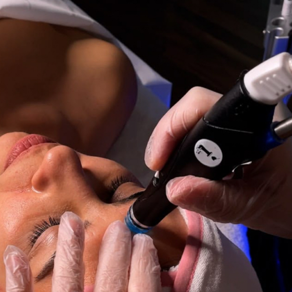 Hydra Facial Deluxe at Mia.skintechh in Terrell, TX