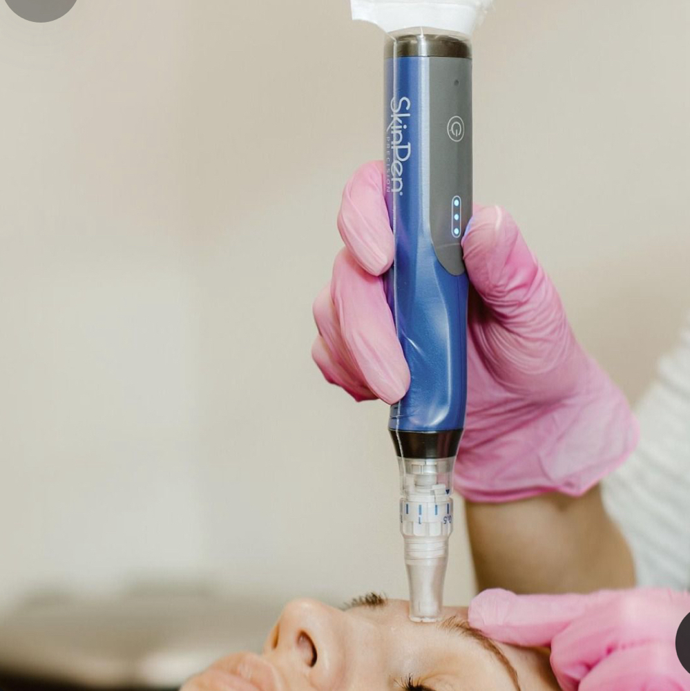 SkinPen Microneedling