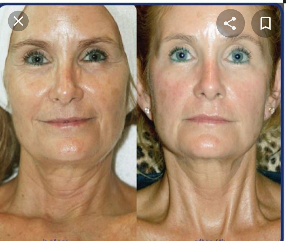 Pro Aging Facial