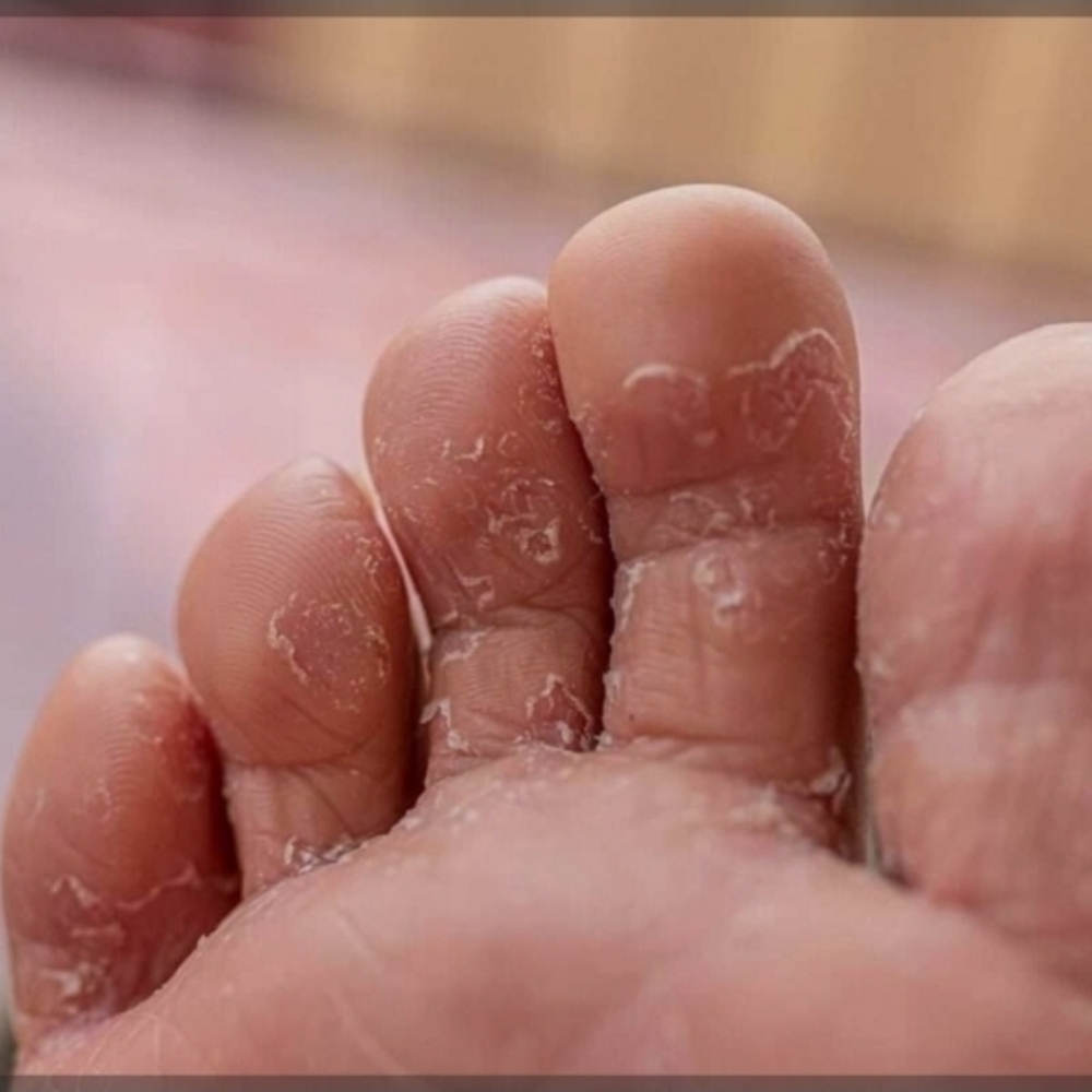 Athletes feet Pedicures at Chicago's Favorite Nail Spa in Lansing, IL