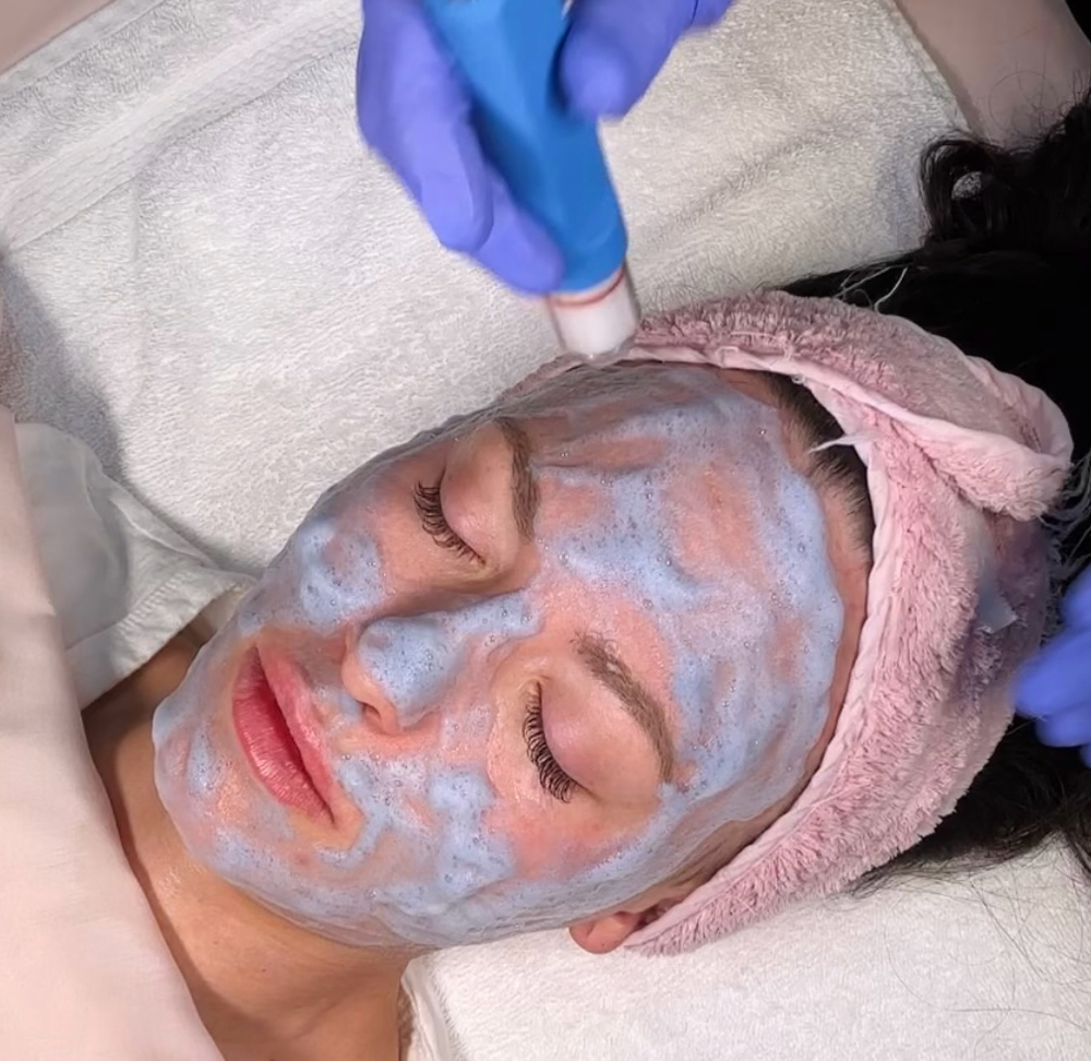Hydroderm Facial